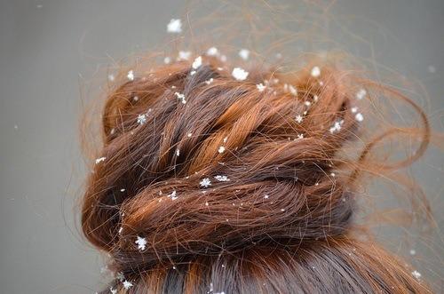 Astuce De Grand Mere Contre Les Pellicules 11 Remedes Naturels Pour Se Debarrasser Des Pellicules