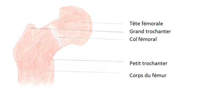 Pourquoi Meurt On D Une Fracture Du Col Du Fémur Que faire en cas de fracture du col du fémur? - Astuces Pratiques